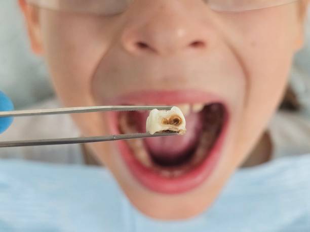 Best Emergency Broken Tooth Repair in Shenandoah, TX